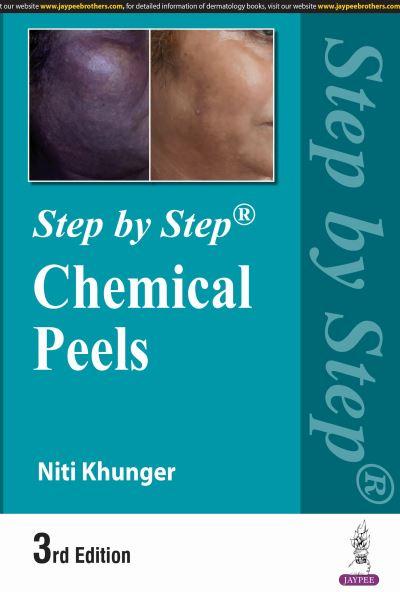 Step By Step: Chemical Peels
