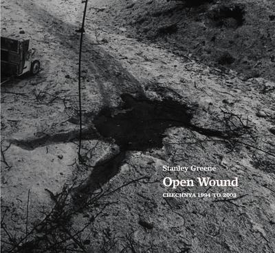 Open Wound
