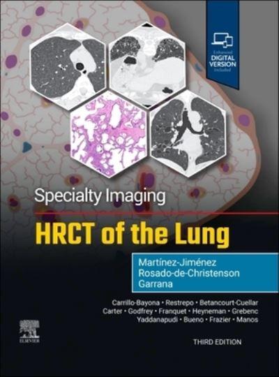 HRCT of the Lung