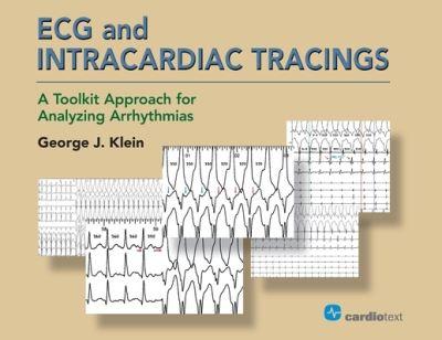 ECG and Intracardiac Tracings
