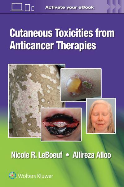 Cutaneous Toxicities From Anticancer Therapies