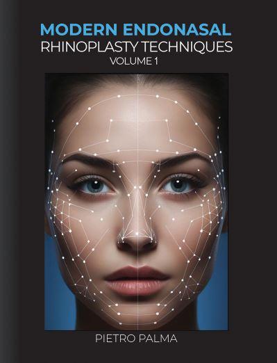 Modern Endonasal Rhinoplasty Techniques. Volume 1