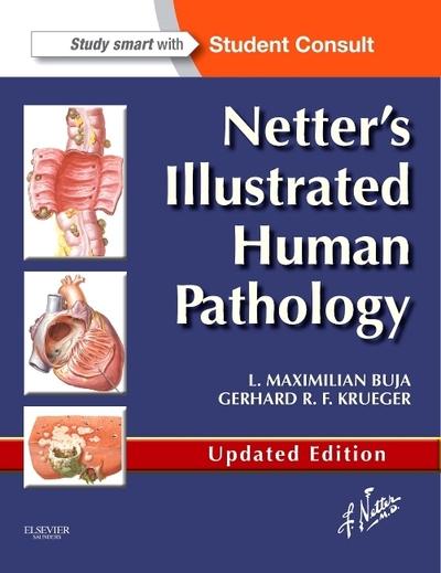 Netter's Illustrated Human Pathology