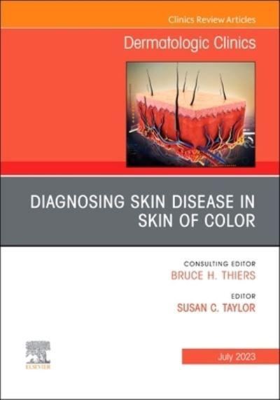 Diagnosing Skin Disease in Skin of Color