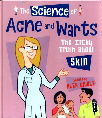 The Science of Acne and Warts