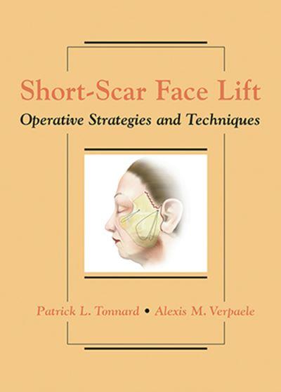 Short-Scar Face Lift