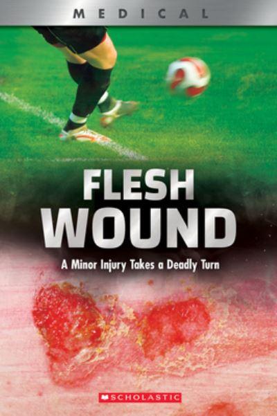 Flesh Wound: A Minor Injury Takes a Deadly Turn (Xbooks)