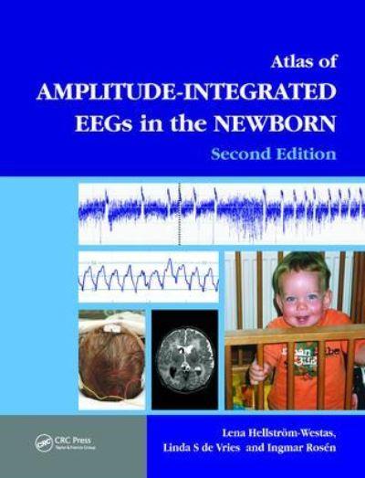 Atlas of Amplitude-Integrated EEGs in the Newborn