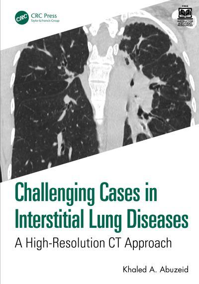 Challenging Cases in Interstitial Lung Diseases